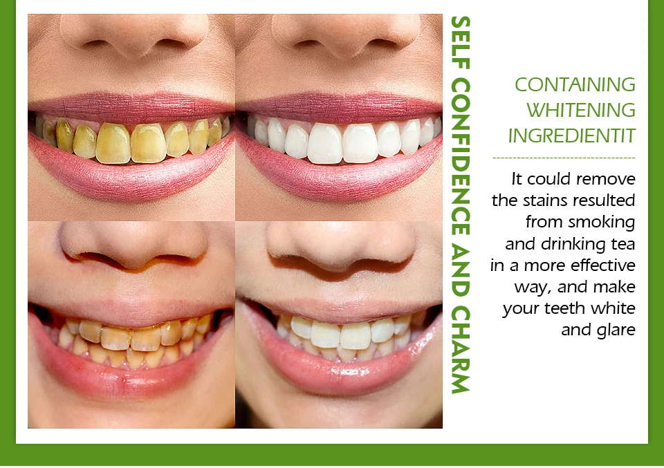 how to make your teeth white fast