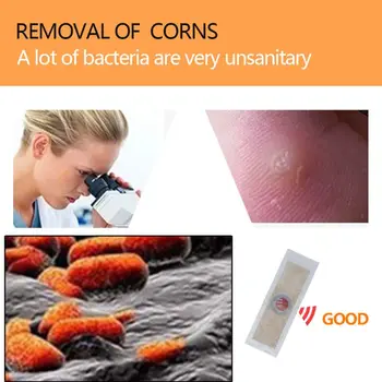 42Pcs Foot Corn Removal Plaster Cure Callus Health Medical Pad Patches Relieving Blisters Painless Warts Thorn Foot Care Tool 
42Pcs Foot Corn Removal Plaster Cure Callus Health Medical Pad Patches Relieving Blisters Painless Warts Thorn Foot Care Tool