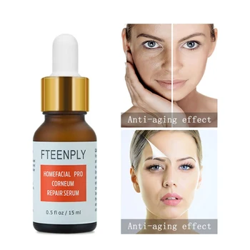 Nicotinamide Solution Facial Serum Brightening And Moisturizing Fine Pores Delicate And Smooth Skin
Nicotinamide Solution Facial Serum Brightening And Moisturizing Fine Pores Delicate And Smooth Skin