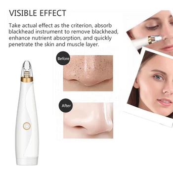 Clean Black Head Cleaner Effective ABS Remove Fast Blackhead Removal Equipment Cosmetic Instrument White Beauty Fashion P1
Clean Black Head Cleaner Effective ABS Remove Fast Blackhead Removal Equipment Cosmetic Instrument White Beauty Fashion P1
