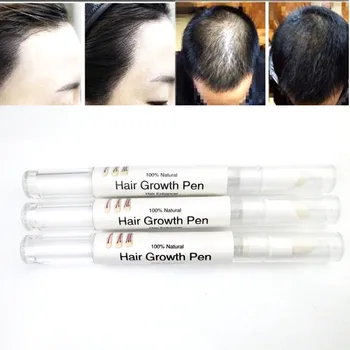 natural faster Grow 5% mi Hair Growth regrowth oil tonic serum products rajout cheveux cure Products Stop Hair Loss treatment
natural faster Grow 5% mi Hair Growth regrowth oil tonic serum products rajout cheveux cure Products Stop Hair Loss treatment