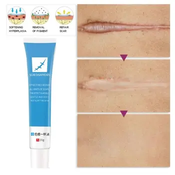 20g Herbal Scar Stretch Marks Removal Cream Acne Skin Repair Antibacterial Gel
20g Herbal Scar Stretch Marks Removal Cream Acne Skin Repair Antibacterial Gel