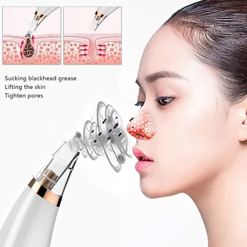 Blackhead Remover Vacuum-Pore Cleaner Electric Suction Facial Acne Extractor Tool Acne Exfoliating Machine Facial Cleansing New 
Blackhead Remover Vacuum-Pore Cleaner Electric Suction Facial Acne Extractor Tool Acne Exfoliating Machine Facial Cleansing New