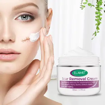 car Removal Cream Stretch Marks Relief And Burns Repair Acne Mark Removal Cream Scars Acne Cream Repair Anti-aging Anti-winkles
car Removal Cream Stretch Marks Relief And Burns Repair Acne Mark Removal Cream Scars Acne Cream Repair Anti-aging Anti-winkles