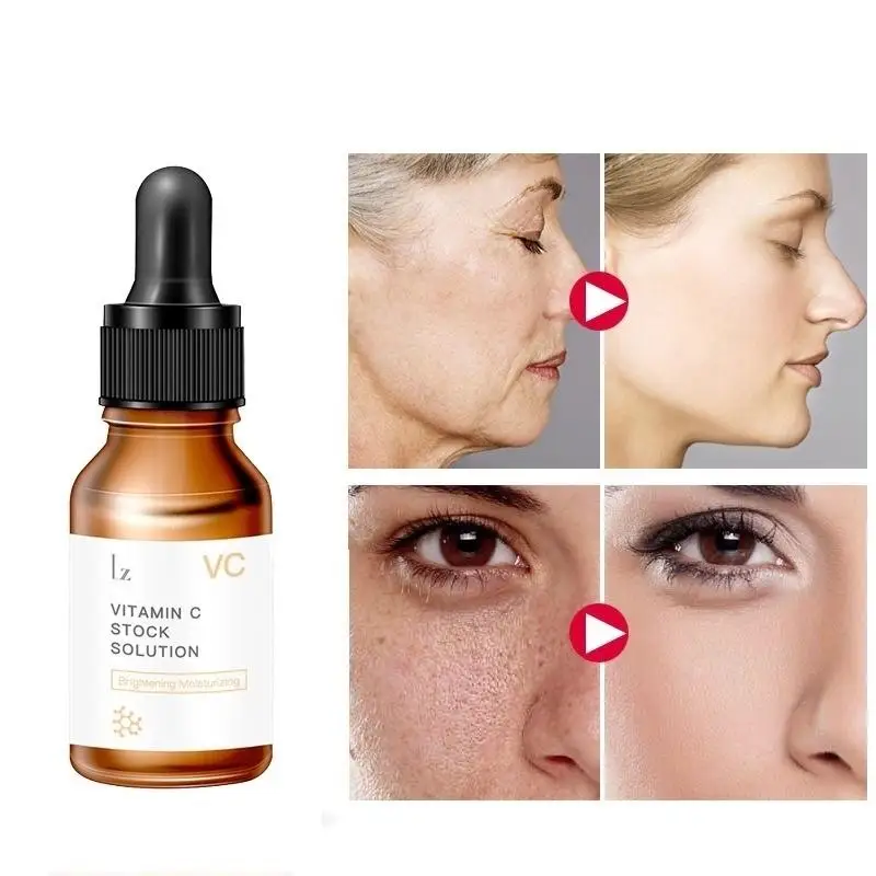 Vitamin C bleaching serum serum hyaluronic acid facial cream remover freckle spots
Vitamin C bleaching serum serum hyaluronic acid facial cream remover freckle spots