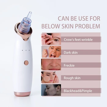 Electric Acne Remover Point Noir Blackhead Vacuum Extractor Tool Black Spots Pore Cleaner Skin Care Facial Pore Cleaner Machine
Electric Acne Remover Point Noir Blackhead Vacuum Extractor Tool Black Spots Pore Cleaner Skin Care Facial Pore Cleaner Machine