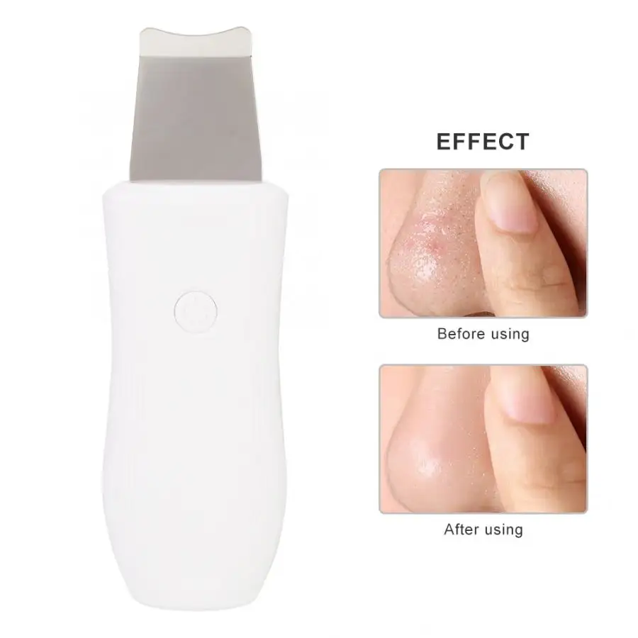 Ultrasonic Skin Scrubber Face Deep Cleansing Spatula Blackhead Acne Removal Beauty Device 3
Ultrasonic Skin Scrubber Face Deep Cleansing Spatula Blackhead Acne Removal Beauty Device 3