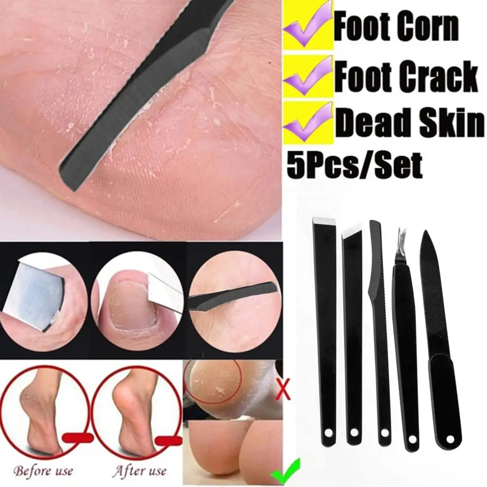 5Pcs Flat Bevel Cutter Scraper Nail File Dead Skin Fork Pedicure Tools Feet Care
5Pcs Flat Bevel Cutter Scraper Nail File Dead Skin Fork Pedicure Tools Feet Care