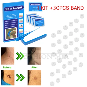 micro skin tag remover Kit quita verrugas face mole Wart removal Micro Band skin tag remove patch For Small To Medium skin tag 
micro skin tag remover Kit quita verrugas face mole Wart removal Micro Band skin tag remove patch For Small To Medium skin tag