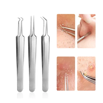 Unisex Stainless Blackhead Extractor Black Dots Remover Tweezer Face Care Comedone Acne Black Spots Tweezers Pimple Blemish
Unisex Stainless Blackhead Extractor Black Dots Remover Tweezer Face Care Comedone Acne Black Spots Tweezers Pimple Blemish