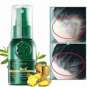 

Effective Ginger Hair Growth Spray Ointment Damaged Hair Nutrition Cream Hair Care Healthy Anti-Hair Loss Essence Oil 30ml
