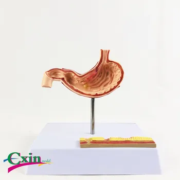 Pathological stomach model human stomach lesion teaching aid digestive system medicine teaching
Pathological stomach model human stomach lesion teaching aid digestive system medicine teaching
