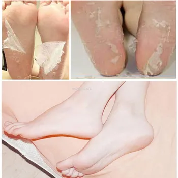 

Hot Remove Dead Skin Foot Mask Peeling Cuticles Heel Feet Care Anti Aging Foot Care Tool