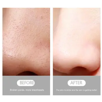 Household small bubbles USB Charging Acne Grease Suction Care Pimple Beauty Removal Blackhead Face Clean Skin Pore T V9V2
Household small bubbles USB Charging Acne Grease Suction Care Pimple Beauty Removal Blackhead Face Clean Skin Pore T V9V2