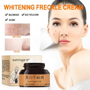 30g Strong Effects Powerful Smooth Skin Whitening Freckle Cream Light Yellow Spot Acne Reduces Age Spots Cream Skin Care TSLM2
30g Strong Effects Powerful Smooth Skin Whitening Freckle Cream Light Yellow Spot Acne Reduces Age Spots Cream Skin Care TSLM2