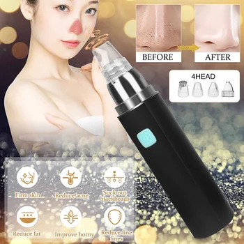 Blackhead Remover with 4 Suction Heads Facial Lipstick Shape Blackhead Acne Remover Skin Face Deep Nose T Zone Care Cleaner
Blackhead Remover with 4 Suction Heads Facial Lipstick Shape Blackhead Acne Remover Skin Face Deep Nose T Zone Care Cleaner