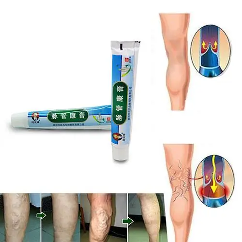 Medical Varicose Veins Treatment Leg Acid Bilges Itching Lumps Vasculitis Cream for people suffering from vasculiti Promotion Pr
Medical Varicose Veins Treatment Leg Acid Bilges Itching Lumps Vasculitis Cream for people suffering from vasculiti Promotion Pr