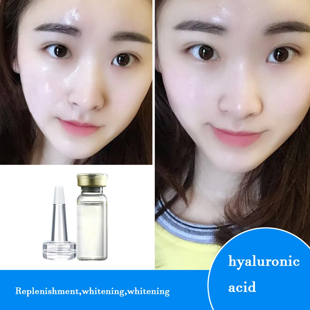 Extract Hyaluronic Acid Daisy Skin Blueberry Chamomile Aloe Lemon Replenishment Moisture 70
Extract Hyaluronic Acid Daisy Skin Blueberry Chamomile Aloe Lemon Replenishment Moisture 70