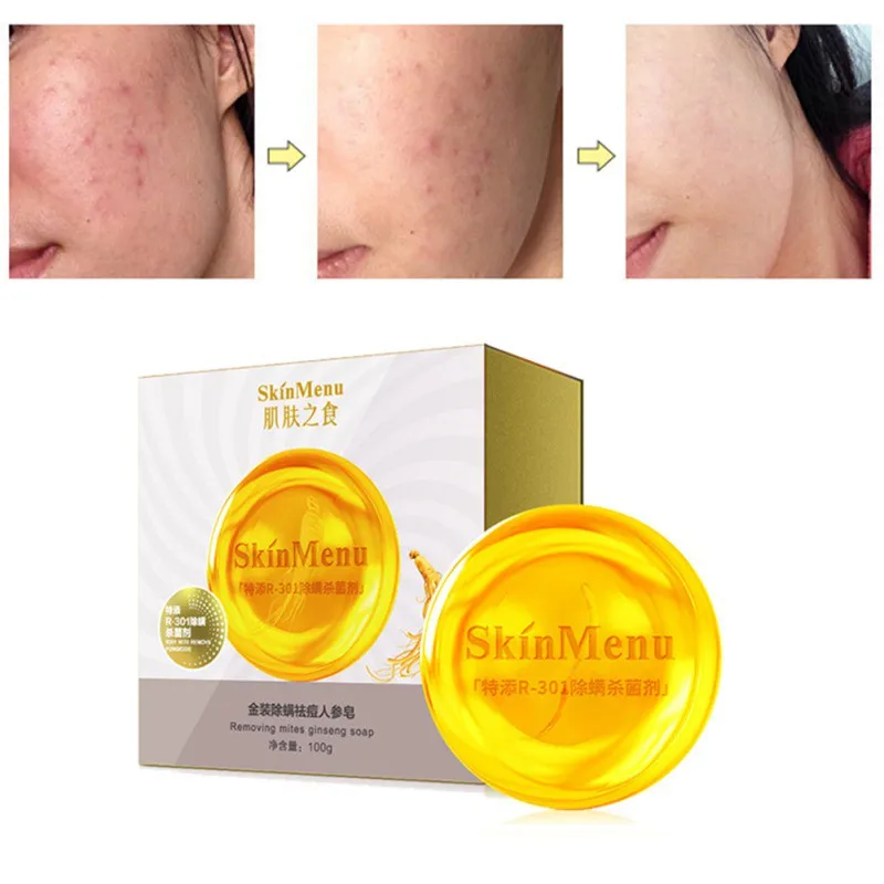 Ginseng Efficient Mite-removing Soap Moisturizing Oil-control Remove Blackheads Handmade Soap Face Care Wash Basis Soap 100g n
Ginseng Efficient Mite-removing Soap Moisturizing Oil-control Remove Blackheads Handmade Soap Face Care Wash Basis Soap 100g n