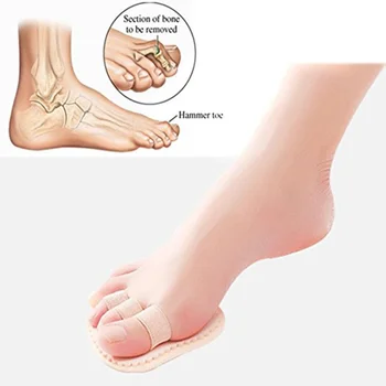 1 Pair Mallet Overlapping Toe Straightener 3-Toe Spreader Correctors
1 Pair Mallet Overlapping Toe Straightener 3-Toe Spreader Correctors