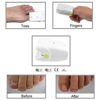 No Pain Rechargeable Nail Fungus Removal Toenail Fungus Soft Laser Therapy Device Fingernails Anti Fungal Infection 
No Pain Rechargeable Nail Fungus Removal Toenail Fungus Soft Laser Therapy Device Fingernails Anti Fungal Infection