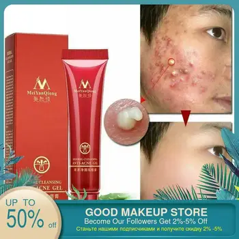 1pcs Face Acne Cleaning Cream Skin Care Remove Repair Comedone Pimple Acne Quickly Face Acne Cream Remover Anti Acne Treatment
1pcs Face Acne Cleaning Cream Skin Care Remove Repair Comedone Pimple Acne Quickly Face Acne Cream Remover Anti Acne Treatment