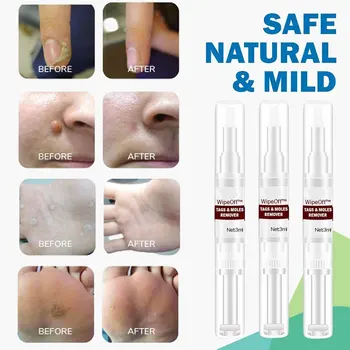 Wholesale Wipe Off Tags Moles Remover 3ml Skin Tags Mole Remover Effective Formula for Skin Tags Removal M3
Wholesale Wipe Off Tags Moles Remover 3ml Skin Tags Mole Remover Effective Formula for Skin Tags Removal M3