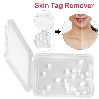 30pcs/box Skin Tag Remover Face Care Acne Non Toxic Warts Treatment Callus Body Rubber Bands Home Painless Mole Nevus
30pcs/box Skin Tag Remover Face Care Acne Non Toxic Warts Treatment Callus Body Rubber Bands Home Painless Mole Nevus