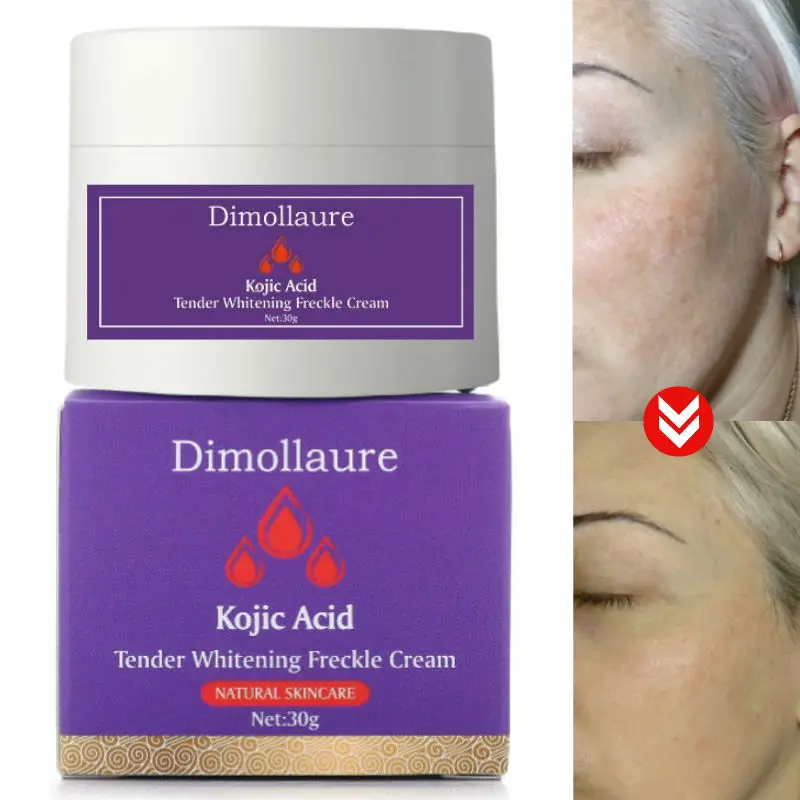 Отбеливающий крем Dimollaure с койевой кислотой, 30 г, ретинол, удаление морщин, веснушек, мелазмы, акне, шрамов, пигмент для возрастных точек, меланина
Отбеливающий крем Dimollaure с койевой кислотой, 30 г, ретинол, удаление морщин, веснушек, мелазмы, акне, шрамов, пигмент для возрастных точек, меланина