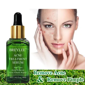 BREYLEE Acne Treatment Face Serum Oil Control Shrink Pores Remove Acne Anti-allergy Moisturizing Face Essence Skin Care
BREYLEE Acne Treatment Face Serum Oil Control Shrink Pores Remove Acne Anti-allergy Moisturizing Face Essence Skin Care
