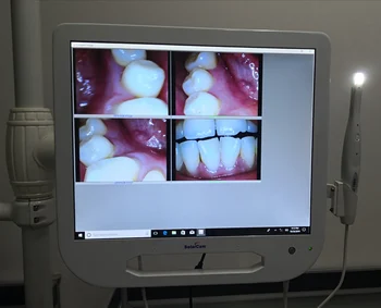 17 Inch Metal Dental Monitor Intraoral Camera System Intel I5 windows10 Touch Screen
17 Inch Metal Dental Monitor Intraoral Camera System Intel I5 windows10 Touch Screen