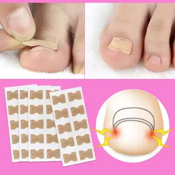 Toenail Correction Tool Brace Pedicure Tool Ingrown Toe Nail Treatment Elastic Patch Sticker Straightening Clip
Toenail Correction Tool Brace Pedicure Tool Ingrown Toe Nail Treatment Elastic Patch Sticker Straightening Clip