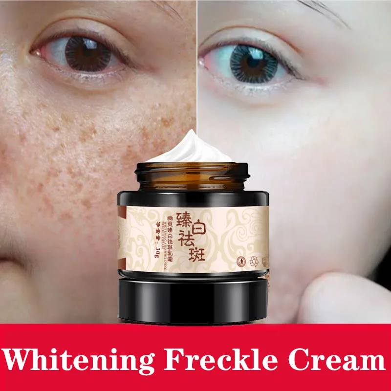 Powerful whitening freckle cream Chinese herbal plant face cream remove freckles and dark spots 30g Skin whitening cream
Powerful whitening freckle cream Chinese herbal plant face cream remove freckles and dark spots 30g Skin whitening cream