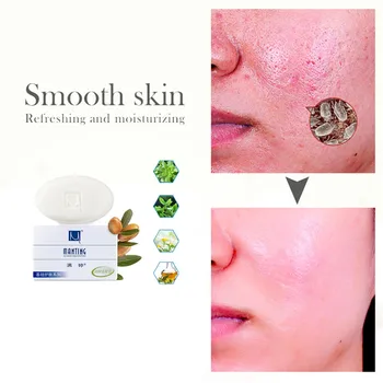 Man Ting Demodex Foam Cleansing Soap hyaluronic acid refreshing dispel black skin rejuvenation acne whitening for men and women
Man Ting Demodex Foam Cleansing Soap hyaluronic acid refreshing dispel black skin rejuvenation acne whitening for men and women