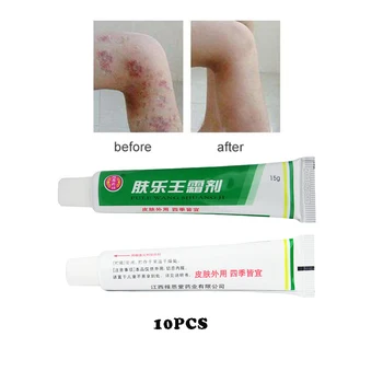 10pcs FULEWANG Skin Psoriasis Cream Dermatitis Eczematoid Eczema Ointment Treatment Psoriasis Cream dropshipping 
10pcs FULEWANG Skin Psoriasis Cream Dermatitis Eczematoid Eczema Ointment Treatment Psoriasis Cream dropshipping