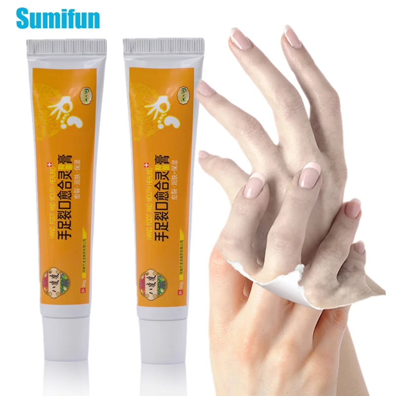 Sumifun Hand Foot Exfoliating Cream Dead Skin Remover Anti-Drying Moisturizing Feet Crack Cream Foot Ointment
Sumifun Hand Foot Exfoliating Cream Dead Skin Remover Anti-Drying Moisturizing Feet Crack Cream Foot Ointment