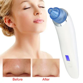 Pore Cleaner Electric Comedone Extractor With 4 Suction Heads Facial Nose Vacuum Handheld 5 Adjustable Level Blackhead Remover
Pore Cleaner Electric Comedone Extractor With 4 Suction Heads Facial Nose Vacuum Handheld 5 Adjustable Level Blackhead Remover