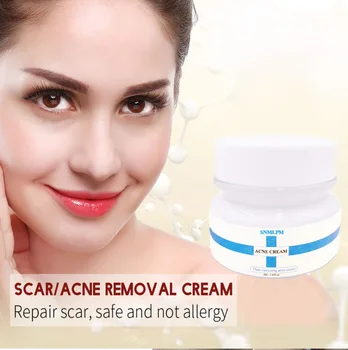 SNMLPM Acne cream tea tree oil acne treatment face skin care Moisturizing whitening oil control shrink pores 50ml
SNMLPM Acne cream tea tree oil acne treatment face skin care Moisturizing whitening oil control shrink pores 50ml