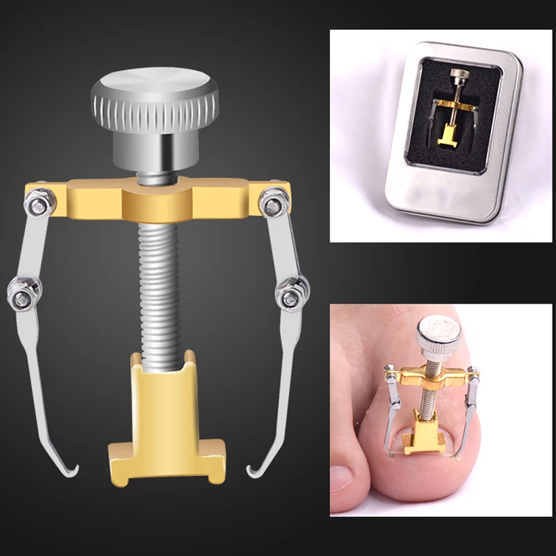 Ingrown Toe Repair Nail Pedicure Foot Care Tool Corrector Professional Paronychia Chiropody Podiatry Repair Nail Treatment Tools
Ingrown Toe Repair Nail Pedicure Foot Care Tool Corrector Professional Paronychia Chiropody Podiatry Repair Nail Treatment Tools