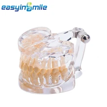 Dental Teeth Model Adult Standard Typodont Demonstration Teach Study Easyinsmile Clear 18.00 * 9.00 * 8.00CM
Dental Teeth Model Adult Standard Typodont Demonstration Teach Study Easyinsmile Clear 18.00 * 9.00 * 8.00CM