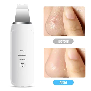 Portable Deep Cleansing Spatula Exfoliating Ultrasonic Spa Face Scrubber Massage Peeling Skin Care Machine Blackhead Removal
Portable Deep Cleansing Spatula Exfoliating Ultrasonic Spa Face Scrubber Massage Peeling Skin Care Machine Blackhead Removal