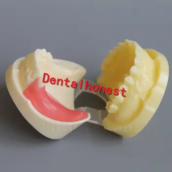 Dental Practice Teeth Study Model Typodont Model 2002-01 Dental Full Implant Drilling Model Dental teaching model
Dental Practice Teeth Study Model Typodont Model 2002-01 Dental Full Implant Drilling Model Dental teaching model