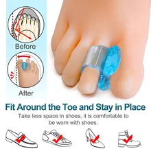 1 Pair Soft Silicone Gel Toe Separator Hallux Valgus Bunion Spacers Thumb Corrector Foot Care Tool
1 Pair Soft Silicone Gel Toe Separator Hallux Valgus Bunion Spacers Thumb Corrector Foot Care Tool