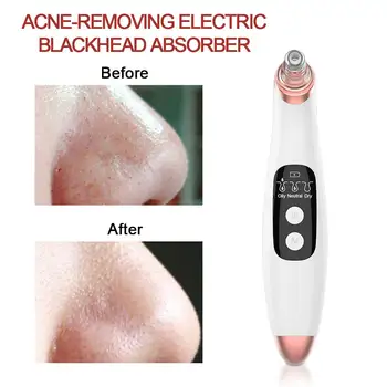 Vacuum Cleaner Black Dots Suction Blackhead Remover for Nose Face Pores Cleanser Black Acne Head Removal Beauty Face Skin Care
Vacuum Cleaner Black Dots Suction Blackhead Remover for Nose Face Pores Cleanser Black Acne Head Removal Beauty Face Skin Care