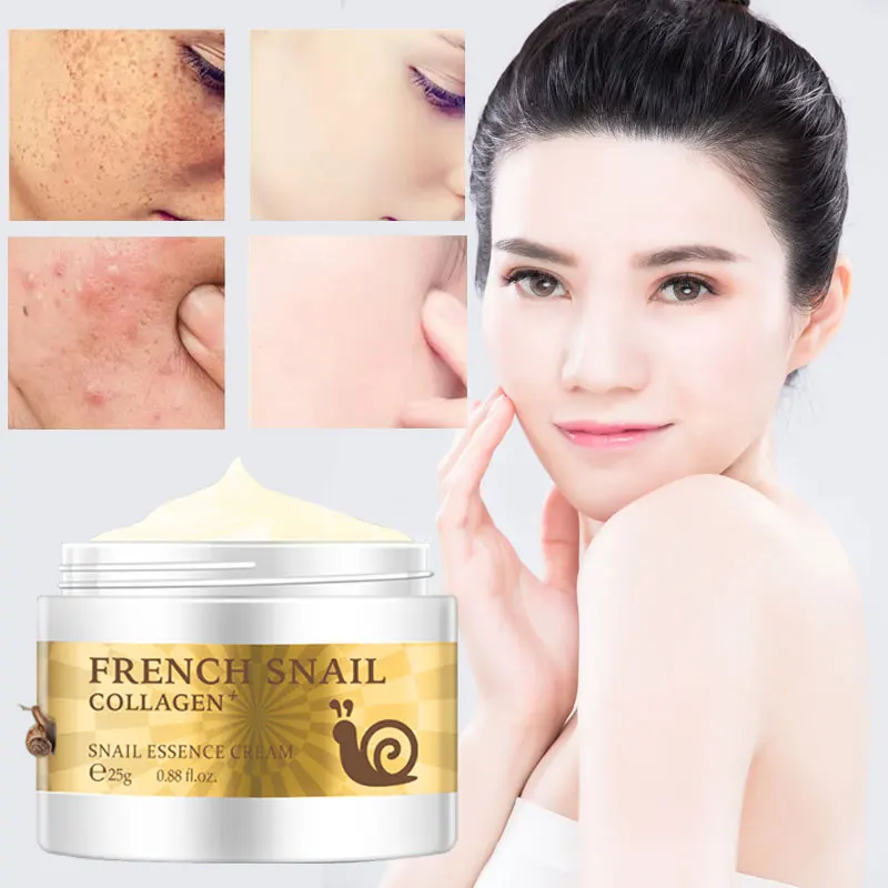 French Snail Collagen Essence Cream Replenishment Moisturizing Oil-Control Anti-Aging Whitening Hyaluronic Acid Glycerol 25g
French Snail Collagen Essence Cream Replenishment Moisturizing Oil-Control Anti-Aging Whitening Hyaluronic Acid Glycerol 25g