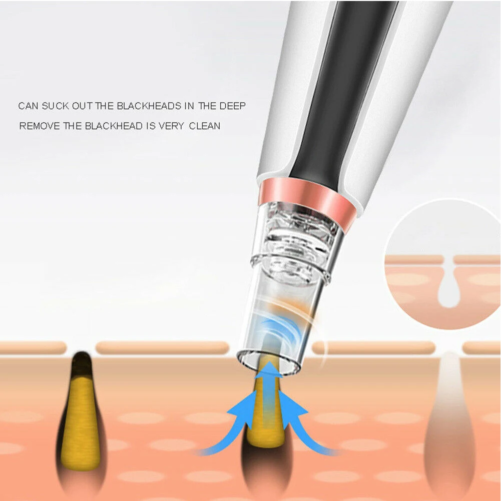 Pore Skin Care Tool USB Charging Vaccum Suction ABS Blackhead Cleaner Adjustable Mode Acne Remover Electric Face Travel Portable 
Pore Skin Care Tool USB Charging Vaccum Suction ABS Blackhead Cleaner Adjustable Mode Acne Remover Electric Face Travel Portable