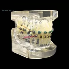 Wrong Jaw correction Teaching Tooth Model M3005/Transparent Orthodontic teeth model/Fault Correction Tooth model With ligature
Wrong Jaw correction Teaching Tooth Model M3005/Transparent Orthodontic teeth model/Fault Correction Tooth model With ligature