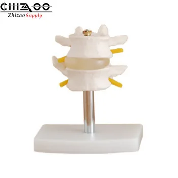 Educational Supply Human Lumbar Vertebrae Lumbar Set Anatomical Model
Educational Supply Human Lumbar Vertebrae Lumbar Set Anatomical Model