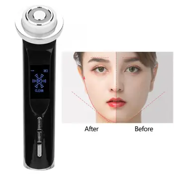 RF EMS Skin Rejuvenation Face Lifting Cleansing Hot Cold Compress Beauty Device Skin Lifting Massager Vibration Device
RF EMS Skin Rejuvenation Face Lifting Cleansing Hot Cold Compress Beauty Device Skin Lifting Massager Vibration Device