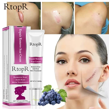 RtopR Repair Removes Scar Cream Care Improves Skin Deep Repair Skin Removes Scars Whitening Skin Firming Skin Lifting Gloss 20g
RtopR Repair Removes Scar Cream Care Improves Skin Deep Repair Skin Removes Scars Whitening Skin Firming Skin Lifting Gloss 20g